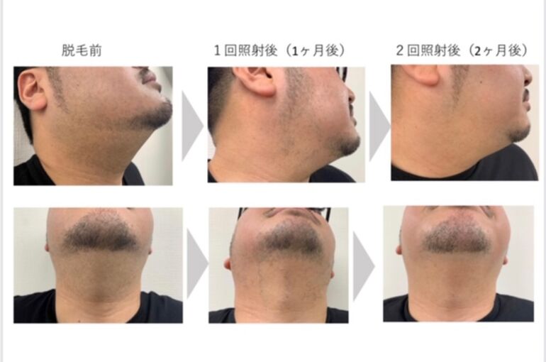 057AE8F3-0BE7-4ADD-955C-829B6A0F885D